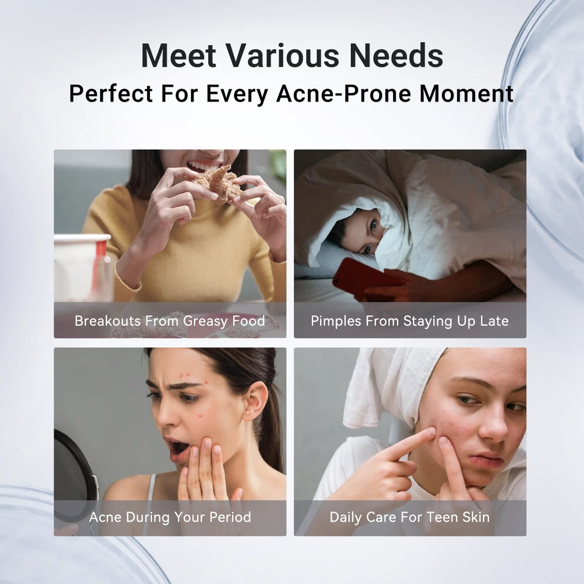 Acne Drying Lotion Plus (1.8% Encapsulated Salicylic Acid)