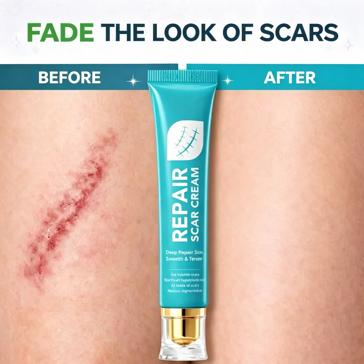 Scar Repair Cream