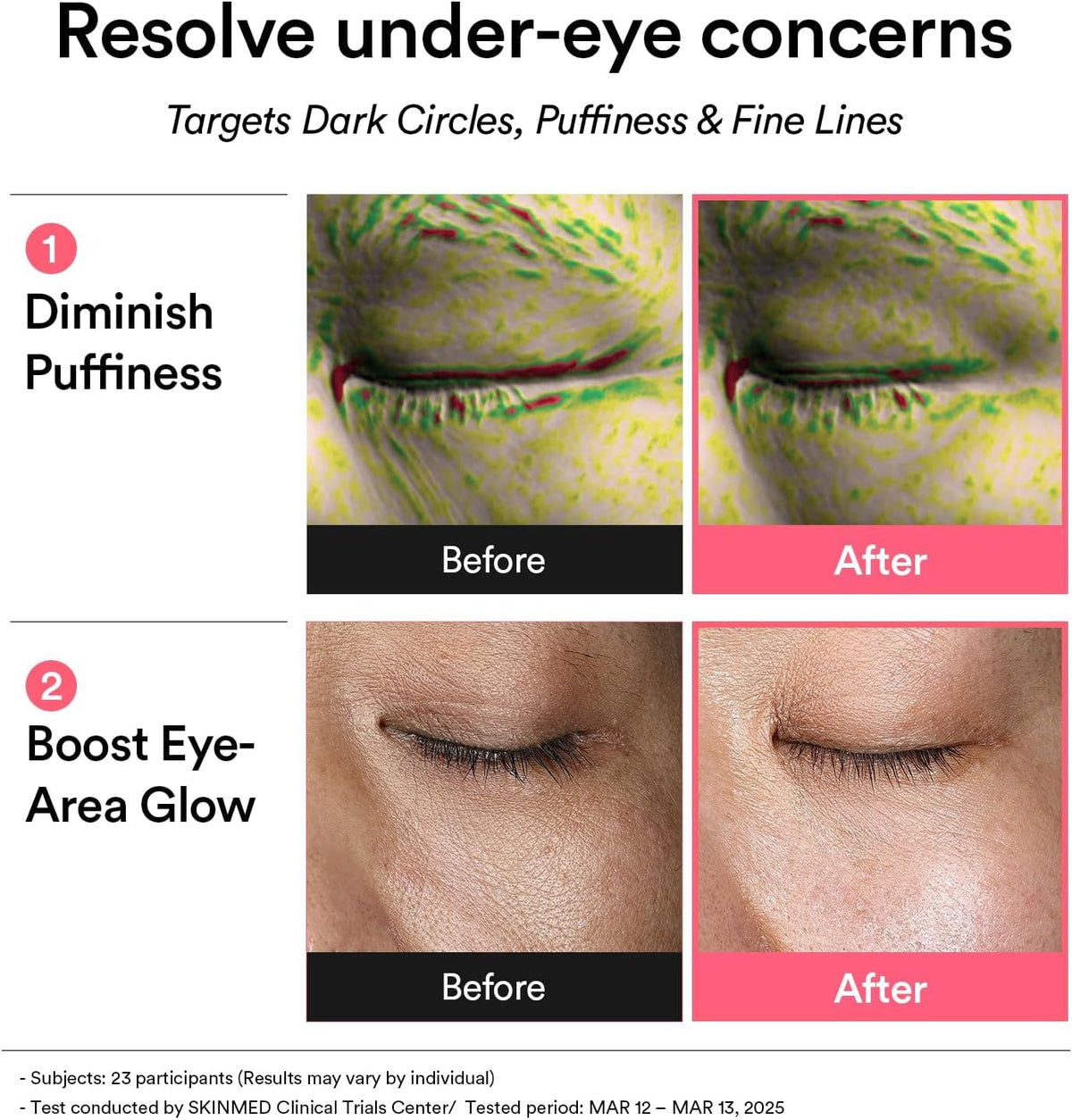 PDRN Retinal Eye Patch Glow Jelly