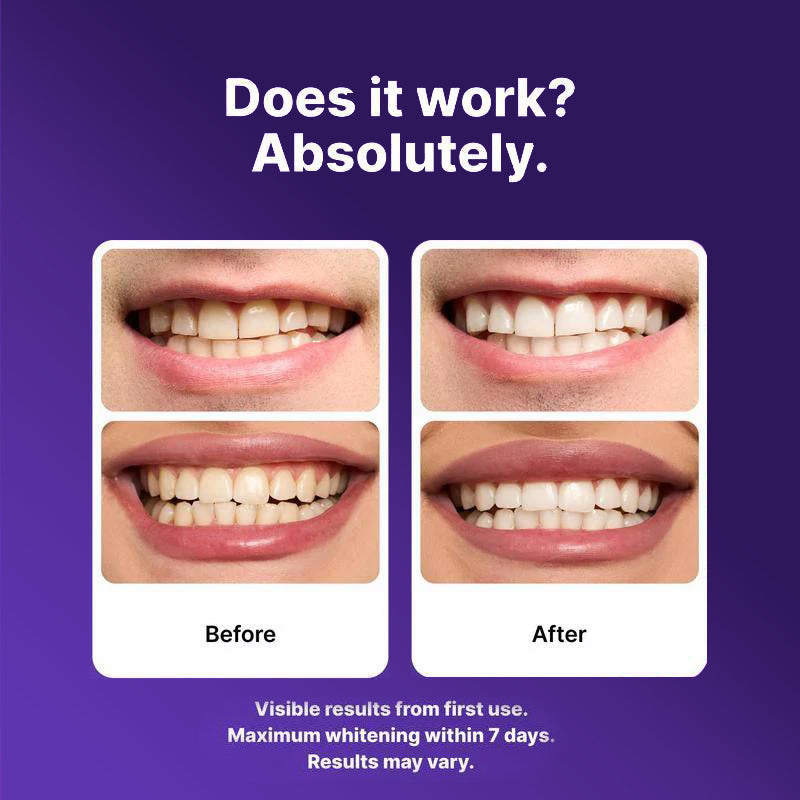 Purple Teeth Whitening Strips – Instant Brightening & Stain Correcting Strips (42 Pack)