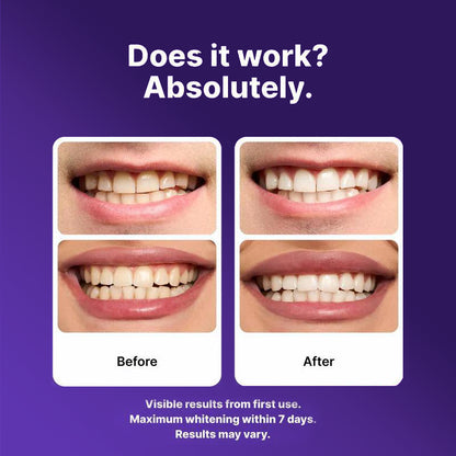 Purple Teeth Whitening Strips – Instant Brightening & Stain Correcting Strips (42 Pack)