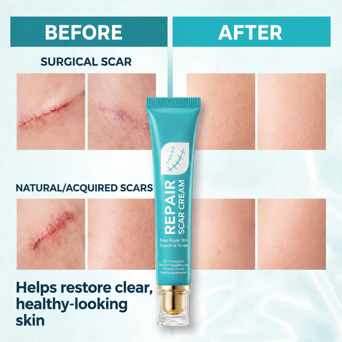 Scar Repair Cream