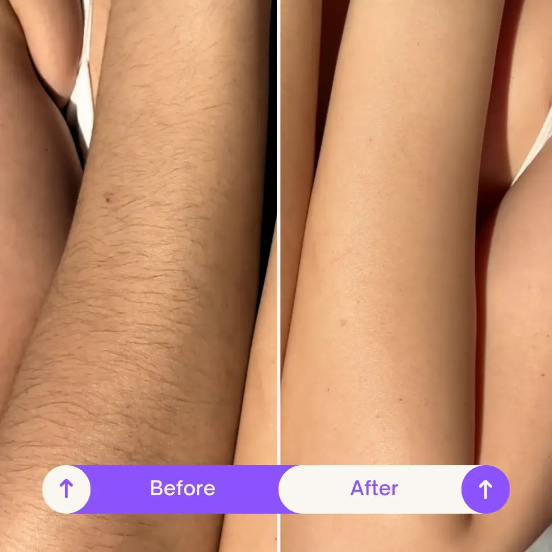 💜Body Hair Removal Cream for Women & Men