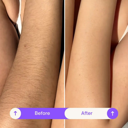 💜Body Hair Removal Cream for Women & Men