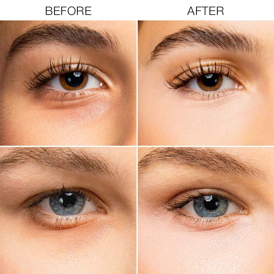 Under Eye Brightener – Dark Circle Corrector & Instant Eye Illuminator