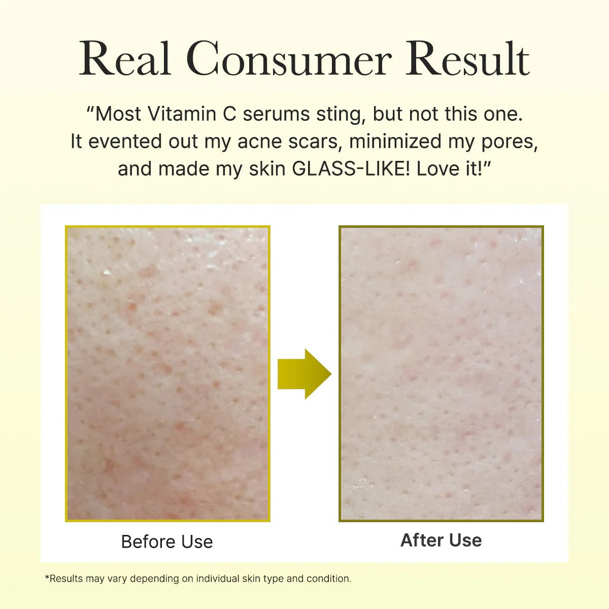 Vitamin C Booster Shot Serum – 1.01 fl oz