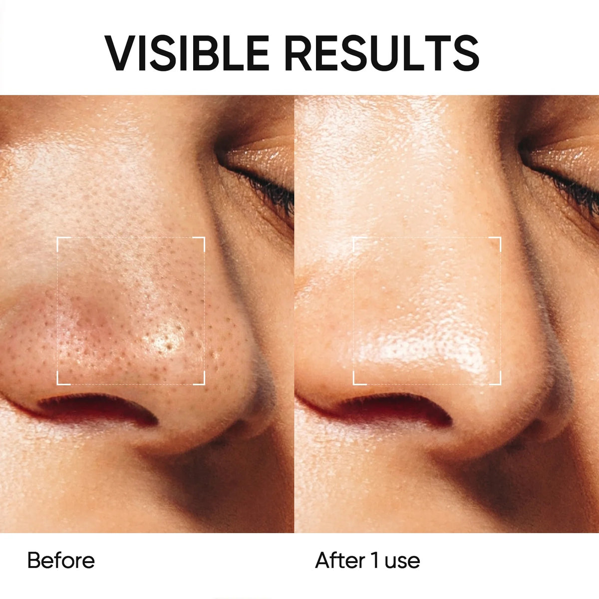 Volcanic Clay Stick Mask for Pores, Acne & Blackheads