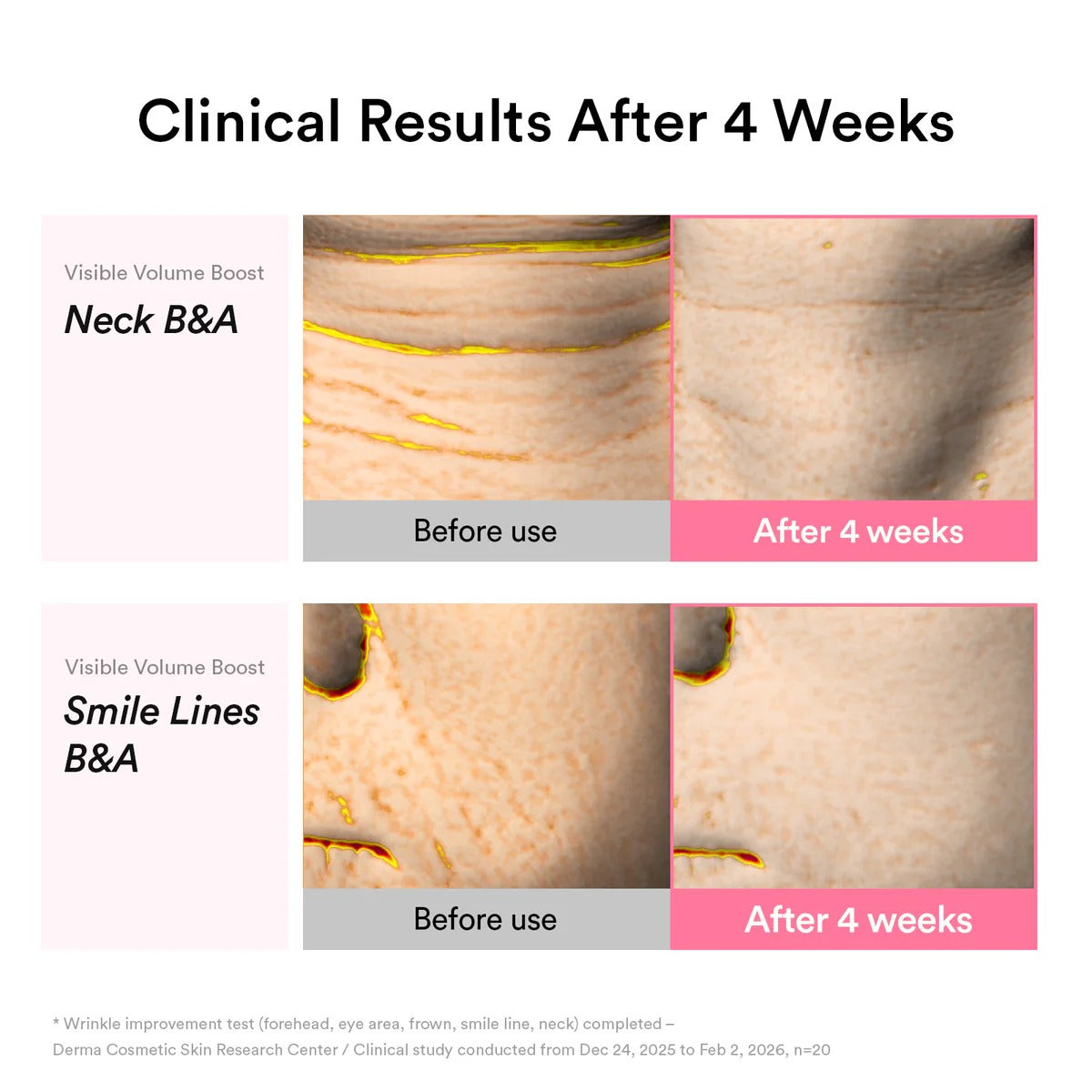 PDRN Volume Fill-It Booster Crème 2.5 Tube – Bounce, Plump & Repair