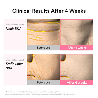 PDRN Volume Fill-It Booster Crème 2.5 Tube – Bounce, Plump & Repair