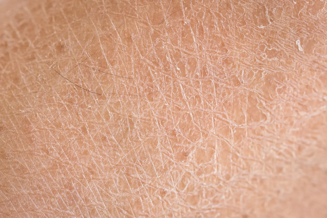 Close-up of dry skin texture