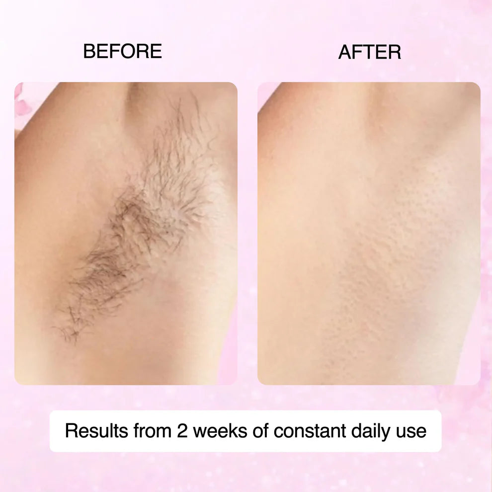 🌿100% Natural Cyperus Rotundus Skin Serum