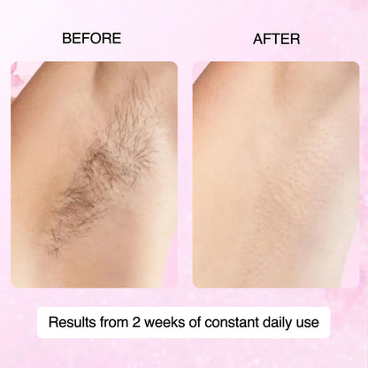 🌿100% Natural Cyperus Rotundus Skin Serum
