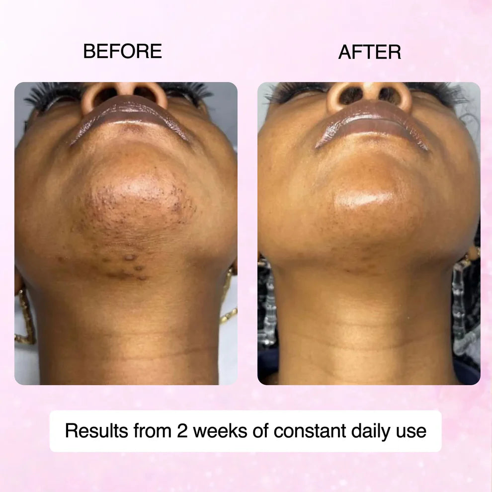 🌿100% Natural Cyperus Rotundus Skin Serum