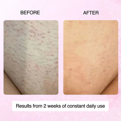 🌿100% Natural Cyperus Rotundus Skin Serum